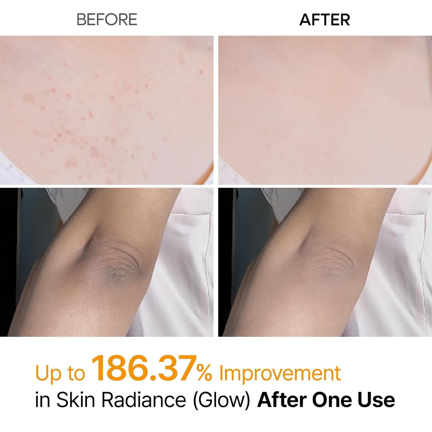 Dr.Melaxin - Peel Shot Kojic Acid Spray