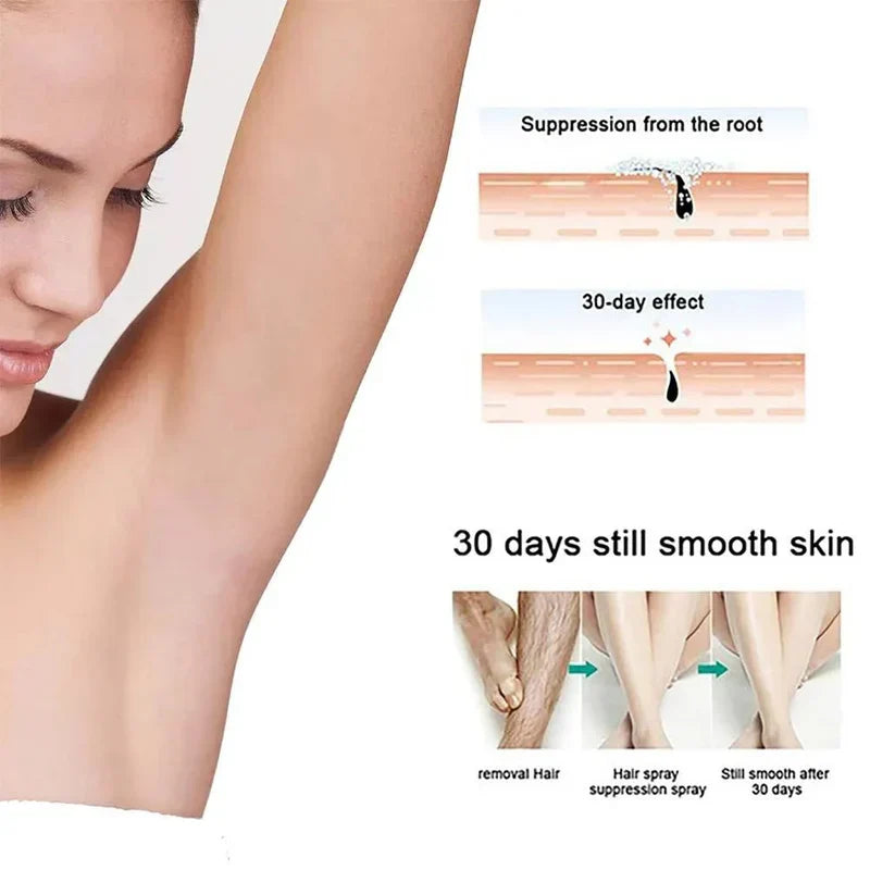 Eelhoe - Hair Removal